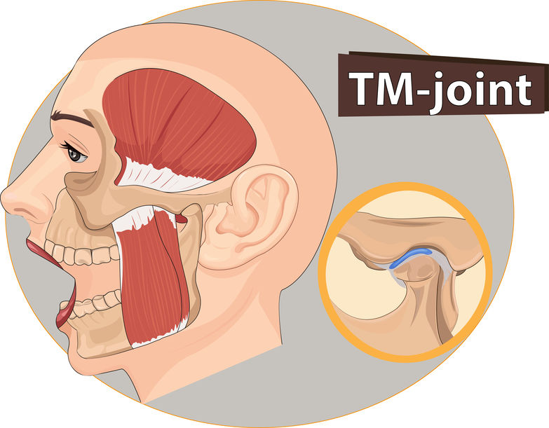 TMJ / TMD - Dentist West Edmonton - Copperwood Dental TMJ / TMD - Dentist West Edmonton - Copperwood Dental